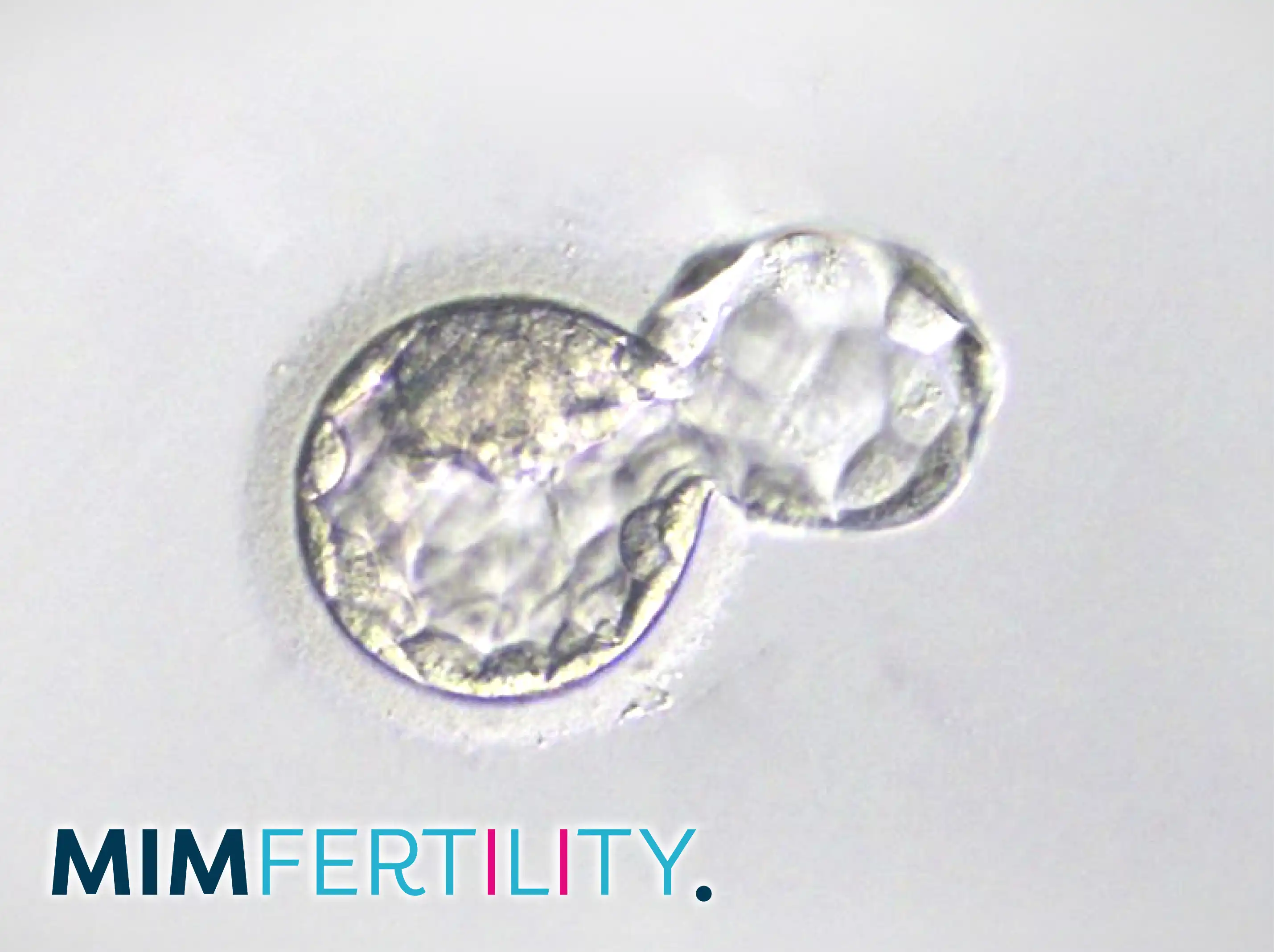 MIM Fertility EMBRYOAID